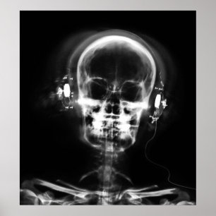 POSTER - X-RAY MUSIC SKELETON BLACK GRAY B&W