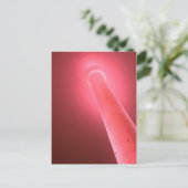 Postkarte - Pinkshot Briefkaart (Staand voorkant)