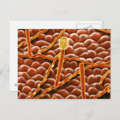 Powdery Mildew Fungus over Poinsettia Briefkaart (Voorkant / Achterkant)