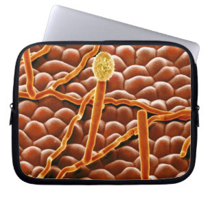 Powdery Mildew Fungus over Poinsettia Laptop Sleeve