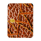 Powdery Mildew Fungus over Poinsettia Magneet (Verticaal)