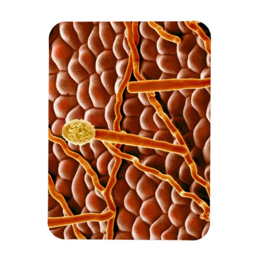 Powdery Mildew Fungus over Poinsettia Magneet (Verticaal)