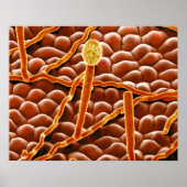 Powdery Mildew Fungus over Poinsettia Poster (Voorkant)