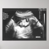 Prank Fake Ultrasound Afbeelding Poster (Voorkant)
