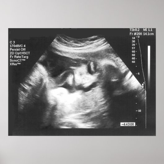 Prank Fake Ultrasound Afbeelding Poster (Voorkant)