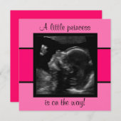 Princess Baby Gepersonaliseerd echografiefotomplat Kaart (Voorkant / Achterkant)