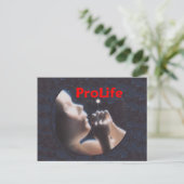 ProLife-Briefkaart Briefkaart (Staand voorkant)