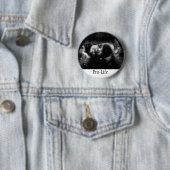 ProLife Ronde Button 5,7 Cm (In situ)