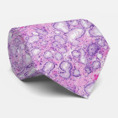 Prostaat Adenocarcinoom Stropdas (Opgerold)