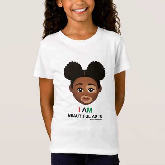 #Proud2BNaturalMe #BeaufulAsis #Vitiligo T-shirt (Voorkant)
