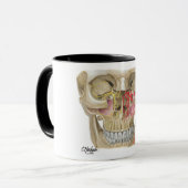 Pterygopalatine Fossa Mok Shot (Voorkant links)