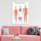 Pulmonaire embolie, route van embolus canvas afdruk (Insitu (Woonkamer))