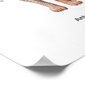 Pulmonaire embolie, route van embolus poster (Hoek)