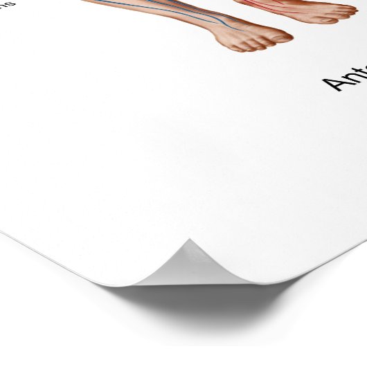 Pulmonaire embolie, route van embolus poster (Hoek)