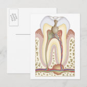 Pulp- en wortelabscess briefkaart (Voorkant / Achterkant)