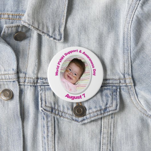 PVNH Disorder Awareness Button met Ella (In situ)