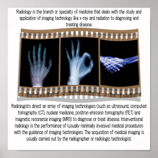 RADIOLOGIE - XRAY POSTER - HAND, OK, HANDSHAKE (Voorkant)