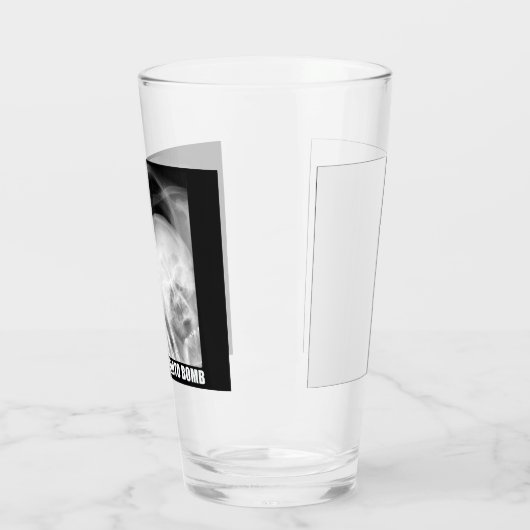 RADIOLOGIST FOTO BOMB GLAS (Links)