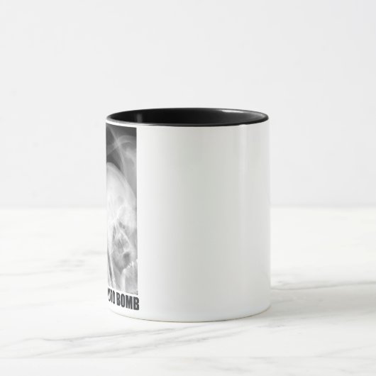 RADIOLOGIST FOTO BOMB MOK (Midden)