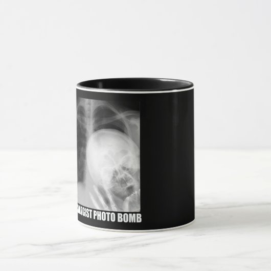RADIOLOGIST FOTO BOMB MOK (Midden)