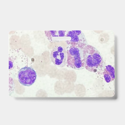 RBCs WBCs preparaat microscoop hematologie lab Badge (Voorzijde)