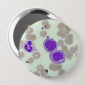RBC's WBC's slide lab microscoop hematologie Ronde Button 4,0 Cm (Voorkant /achterkant)