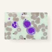 RBC's WBC's Slide Microscoop Hematologie Lab Badge (Achterkant)