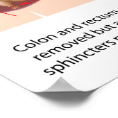 Restoratieve proctocolectomie met j-pouch 2 fasen poster (Hoek)