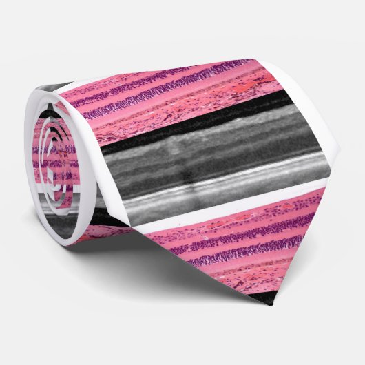 Retina Stropdas (Opgerold)