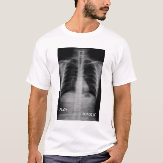 “Retro VHS X-Ray” Old-school chest X-ray with VHS T-shirt (Voorkant)