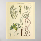 Rib Cage Sternum Anatomy Art Print (Voorkant)