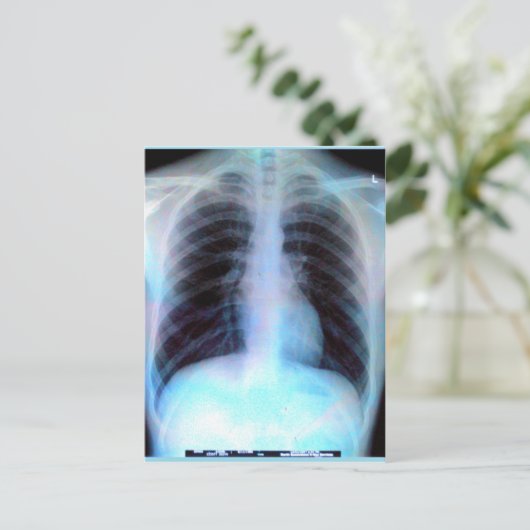 Ribcage Xray Skeleton Briefkaart (Staand voorkant)