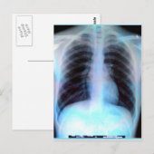 Ribcage Xray Skeleton Briefkaart (Voorkant / Achterkant)