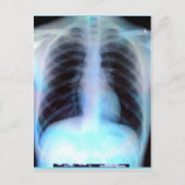 Ribcage Xray Skeleton Briefkaart (Voorkant)
