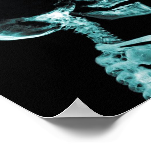 roken van röntgenposter poster (Hoek)