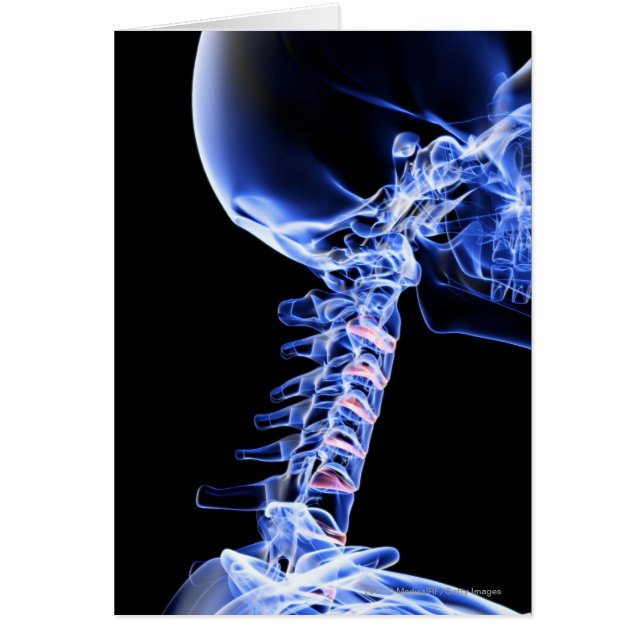 Röntgenafbeelding van de botten van de nek (Voorkant)