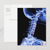 Röntgenafbeelding van de botten van de nek briefkaart (Voorkant / Achterkant)