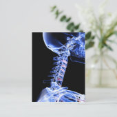 Röntgenafbeelding van de botten van de nek briefkaart (Staand voorkant)