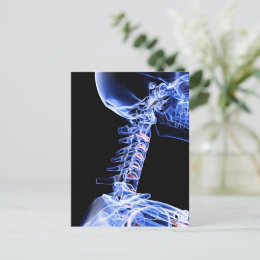 Röntgenafbeelding van de botten van de nek briefkaart (Staand voorkant)