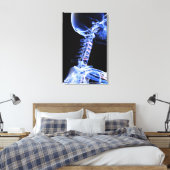 Röntgenafbeelding van de botten van de nek canvas afdruk (Insitu (Slaapkamer))