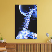 Röntgenafbeelding van de botten van de nek canvas afdruk (Insitu (Woonkamer))