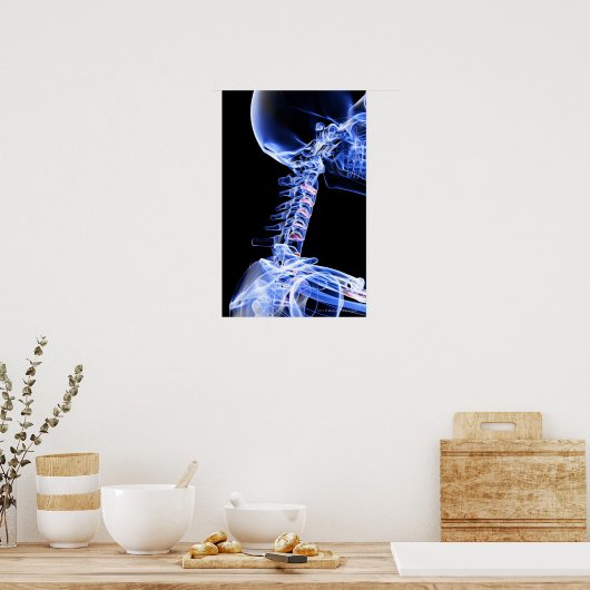 Röntgenafbeelding van de botten van de nek poster (Keuken)