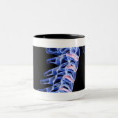 Röntgenafbeelding van de botten van de nek tweekleurige koffiemok (Center)