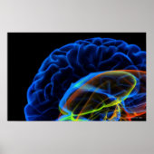 Röntgenafbeelding van de hersenen poster (Voorkant)