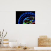 Röntgenafbeelding van de hersenen poster (Keuken)