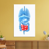 röntgenAfbeelding van interne organen met een klei Canvas Afdruk (Insitu (Woonkamer))