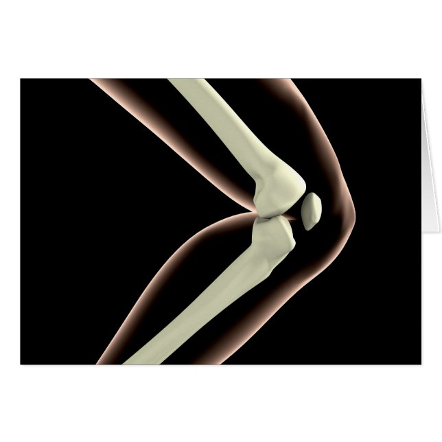 RöntgenAfbeelding van knie 1 (Voorkant Horizontaal)