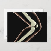 RöntgenAfbeelding van knie 1 Briefkaart (Voorkant / Achterkant)