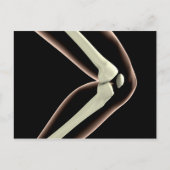 RöntgenAfbeelding van knie 1 Briefkaart (Voorkant)