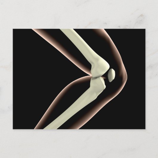 RöntgenAfbeelding van knie 1 Briefkaart (Voorkant)